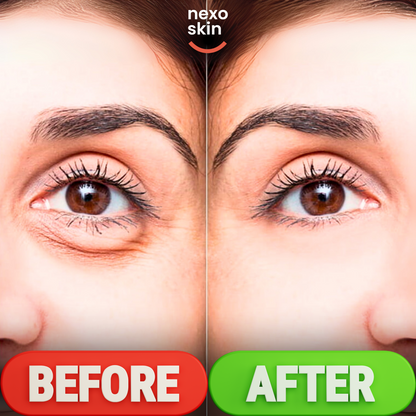 Dermatologist-Approved Eye Roller Serum