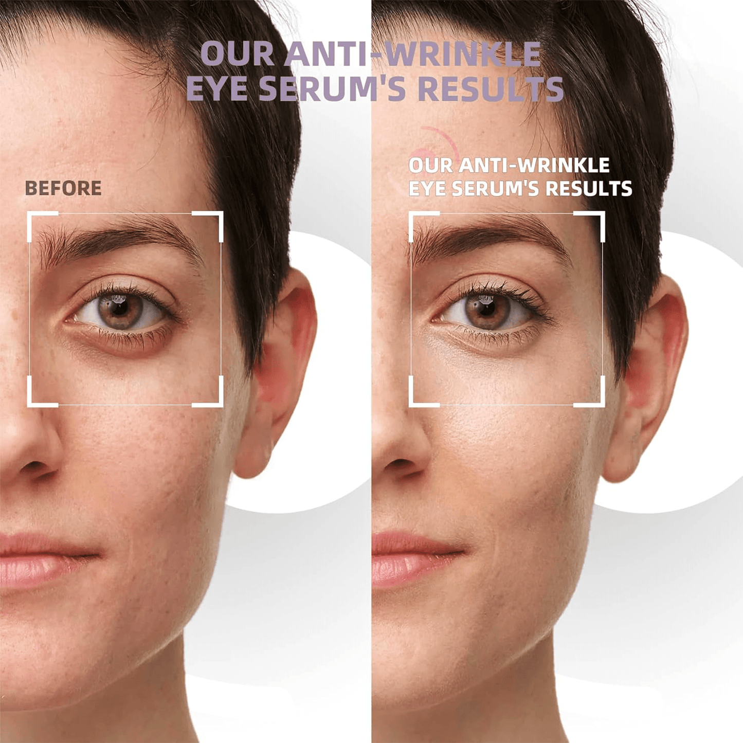 Eye Roller | Eliminates Dark Circles & Puffy Eyes - Nexo